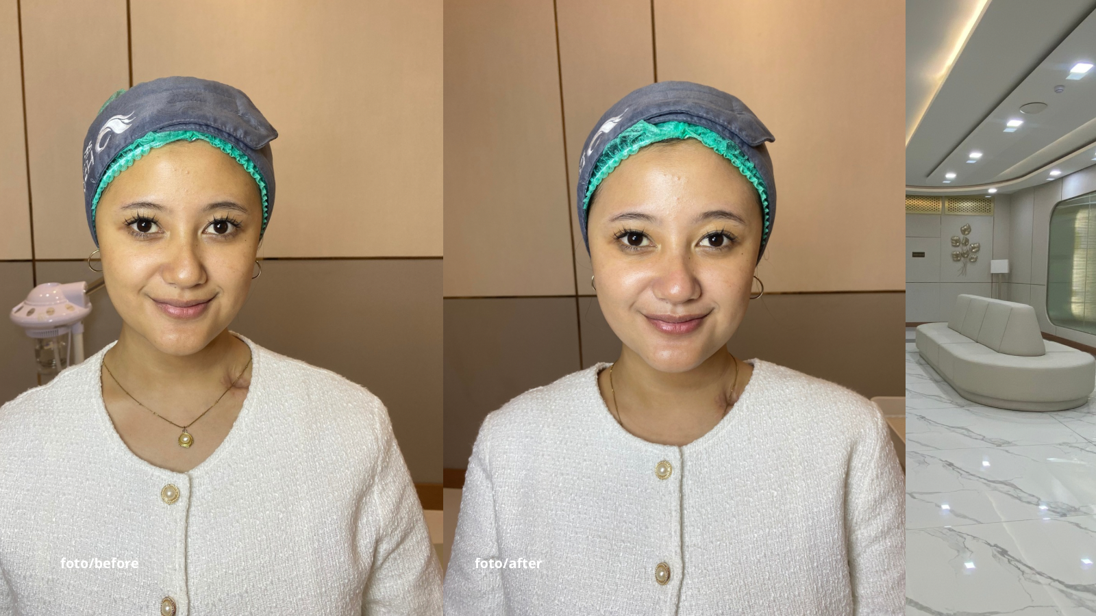 Klinik mewah di Bandung HSK Secret Bandung dengan konsultasi dokter gratis dan treatment mulai Rp199 ribu